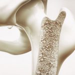Osteokalcyna – normy, badanie. Czym właściwie jest to białko?