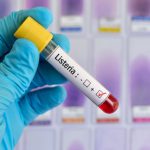 Zakażenie bakterią Listeria monocytogenes – możliwe źródła infekcji i objawy choroby