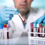 Znaczenie diagnostyki laboratoryjnej w wykrywaniu chorób nowotworowych