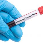 Hemofilia nabyta – co to jest?