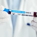 Szybki test antygenowy jakościowy SARS-CoV-2 z wynikiem w języku angielskim