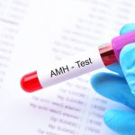 Badanie AMH – ocena rezerwy jajnikowej. Kiedy je wykonać?