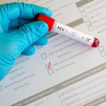 Rola badania przeciwciał anty-HCV w rozpoznawaniu wirusowego zapalenia wątroby