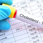 Cholesterol całkowity – badanie, normy, interpretacja wyników